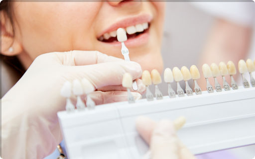 ホワイトニング