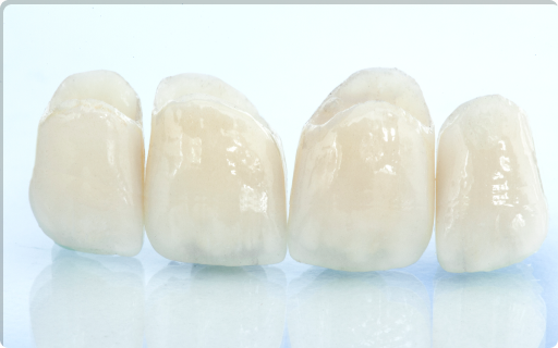 つめ物・かぶせ物